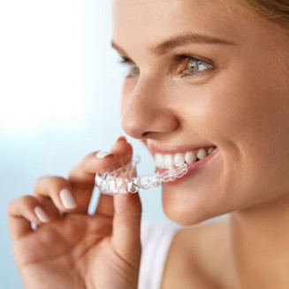 clear aligners